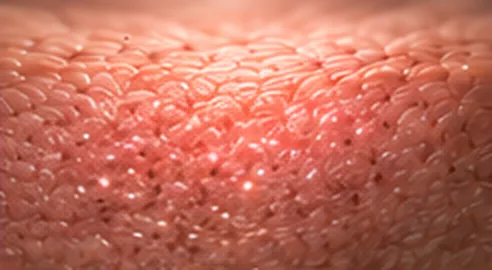 Illustration of step 3: Skin renewal