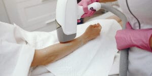 Laser Hair Removal