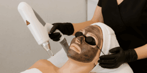 How to Prepare for Your First Carbon Facial in Christchurch, New Zealand